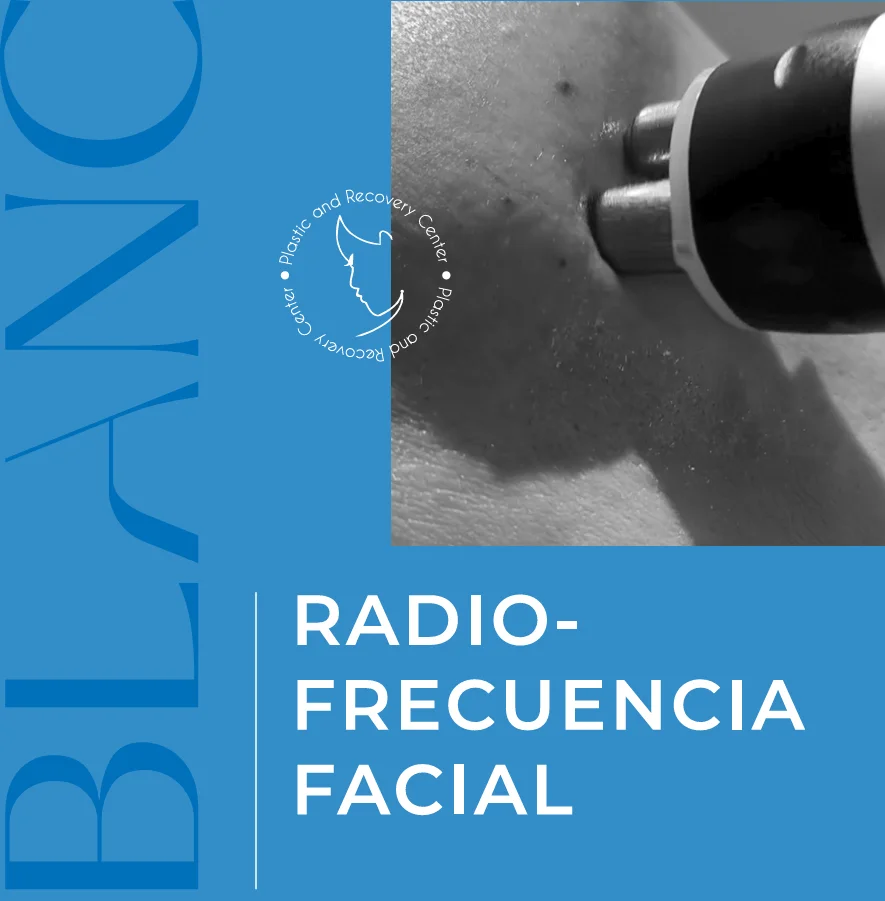 Radiofrecuencia Facial